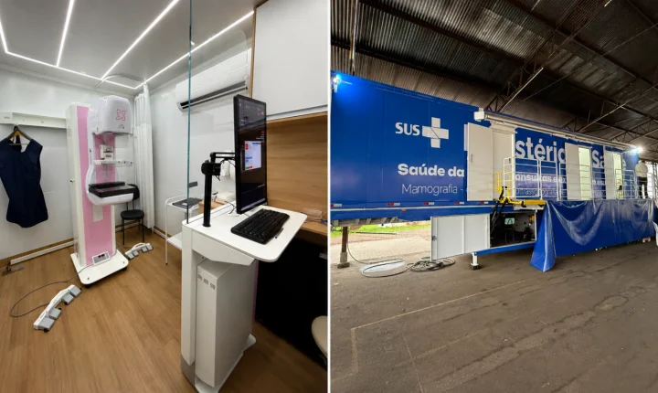 Carreta da Saúde retorna a Estância Velha para exames voltados à saúde da mulher 