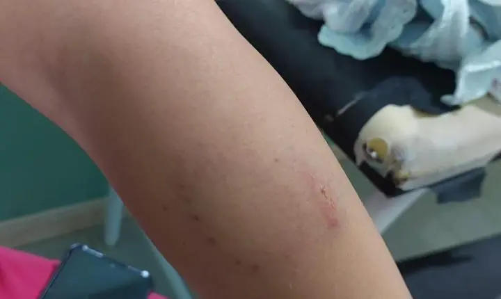 Homem agride companheira na frente das filhas e foge em Estância Velha