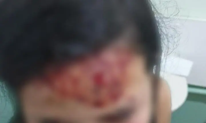 Homem agride companheira na frente das filhas e foge em Estância Velha